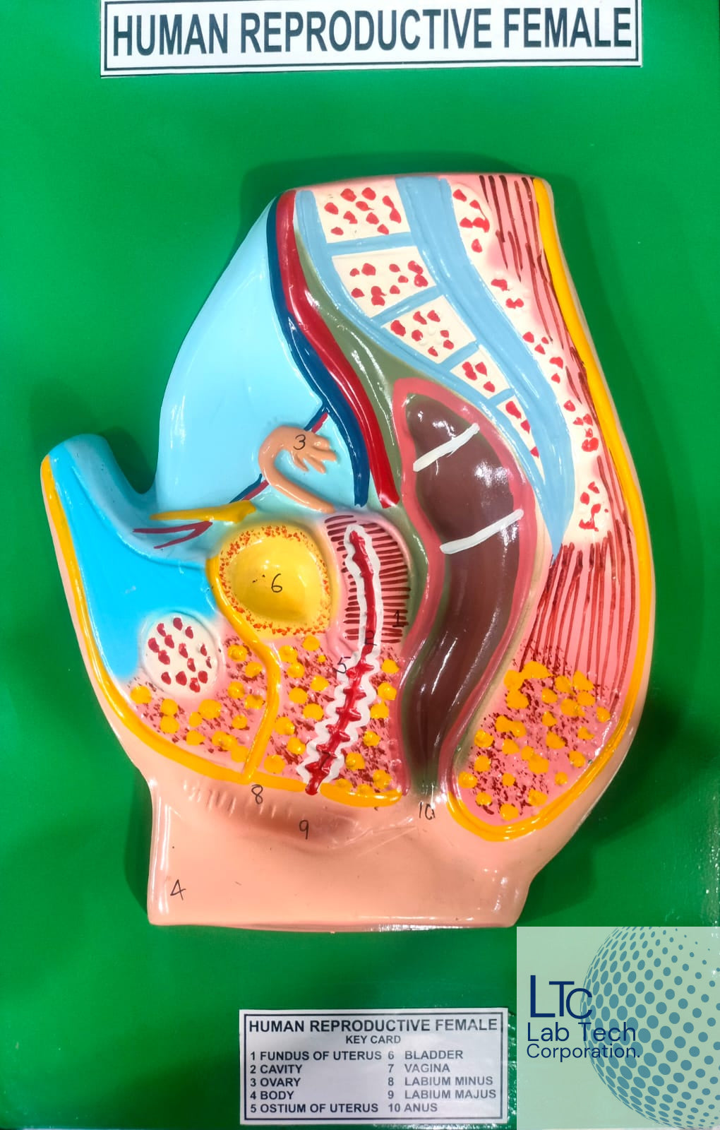 Reprouctive Human Female Reproductive System Model – M/S LAB TECH CORPORATION