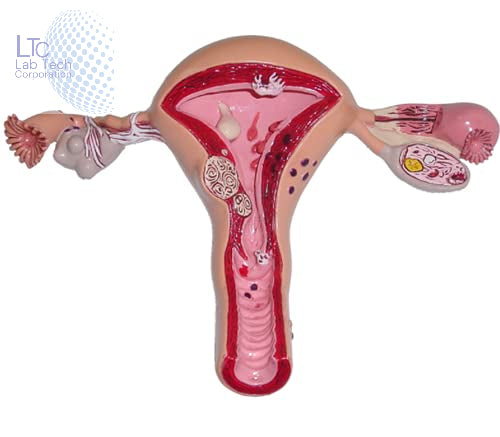 Uterus and Ovary Anatomy Model