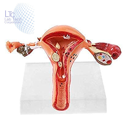 Uterus and Ovary Anatomy Model